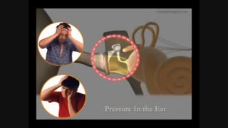 اوتیت میانی