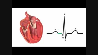 مقدمات ECG