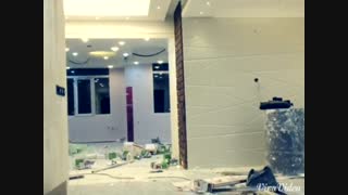 مراحل اجرایی مطب دندانپزشکی دکتر عزیزی عصب‌کشی