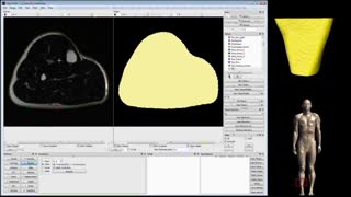 جدید ترین روش در اسکن پیشرفته و تهیه فانتوم مدل سازی شده از بیمار