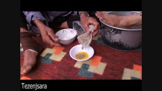 درمان دررفتگی،کوفتگی،شکستگی به روش سنتی توسط اقای احمدزاده