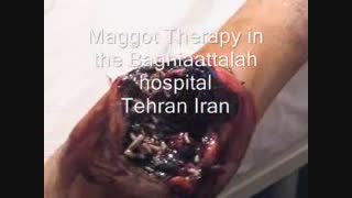 درمان به روش لارو درمانی