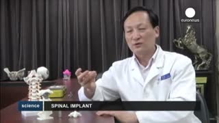 فناوری چاپ سه بعدی در خدمت جراحی ستون فقرات