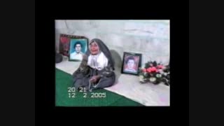 خانواده شهید غلامحسین حسن زاده عمل زیبایی