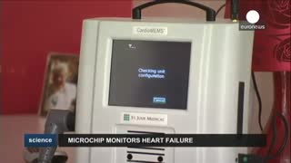 ریز تراشه برای کنترل وضع بیماران قلبی از راه دور