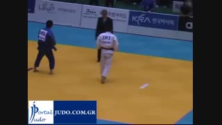 مسابقه میراسماعیلی و مغول لیفت گردنایمپلنت دندان
