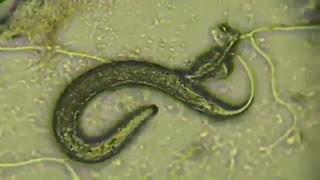 اولین ویدئوی ضبط شده از یک نماتد خاکزی توسط Drechslerella anchonia
