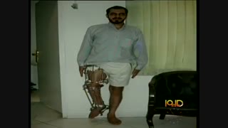 عمل جراحی افزایش قد