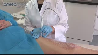 ترمیم اسکار سوختگی با دستگاه میکرونیدلینگ amieamed رادیوگرافی دندان