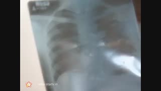 قسمت 587 سریال دیل میل گایه