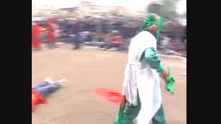 تعزیه خوانی امامعلی پورصادق آرباطان تزریق چربی