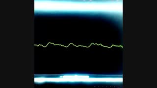 دمو زیبا از آهنگ جدید یوسف زمانی