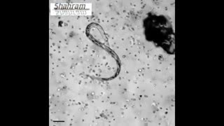 حمله گلبول های سفید به انگل ها