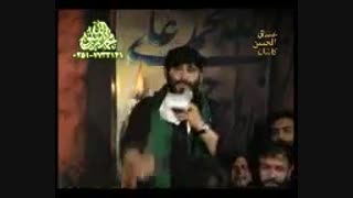 یا ابا عبدالله الحسین کشیدن دندان
