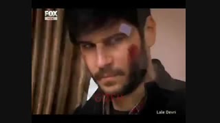 عمرگل لاله اتوپلاستی