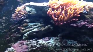 ٍEMDR  یک جلسه درمان