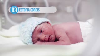 10 بیماری نادر و عجیب و غریب