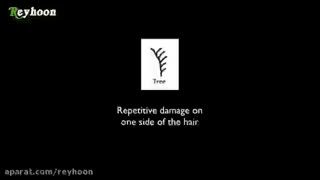 درمان موخوره:)