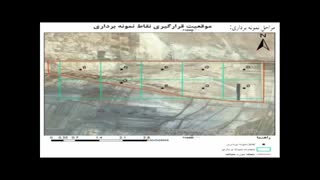 ویدا صفایی پروتز سینه