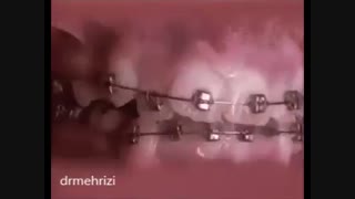 درمان توسط متخصص ارتودنسی
