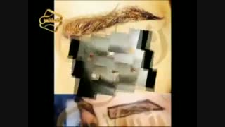 کاشت ابرو طبیعی با روش SUT مرکز کاشت مو رنسانس کربوکسی تراپی