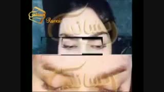 کاشت ابرو طبیعی با روش SUT مرکز کاشت مو رنسانس عمل زیبایی