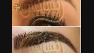 کاشت ابرو طبیعی با روش SUT مرکز کاشت مو رنسانس لمینت