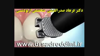 ارتودنسی مزوتراپی