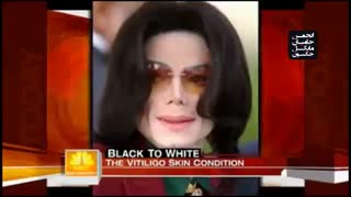 آیا مایکل جکسون واقعا تغییر جنسیت داد؟ (دلیل تغییر رنگ پوست مایکل جکسون)