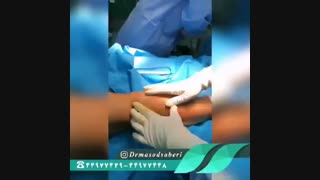 تعویض مفصل زانو | دکتر مسعود صابری متخصص ارتوپد پلاستیک لثه
