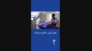 عمل لیزر داخل دیسک