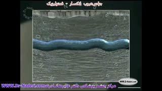 جراحی فمتولیزیک - مرکز چشم پزشکی دکتر علیرضا نادری