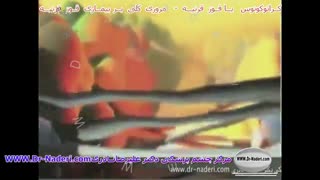 پیوند قرنیه - مرکز چشم پزشکی دکتر علیرضا نادری