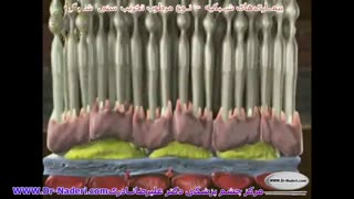 نوع مرطوب تخریب سنی لکه زرد - مرکزچشم پزشکی دکترعلیرضا نادری