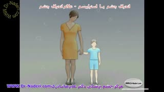 علائم استرابیسم - مرکز چشم پزشکی دکتر علیرضا نادری