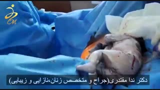 زایمان طبیعی توسط دکتر ندا مقتدری ماموپلاستی
