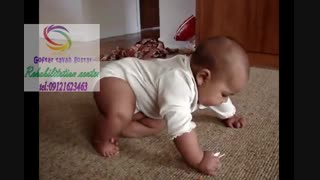 فلج مغزی در کودکان و بزرگسالان