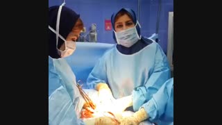 خارج کردن رحم