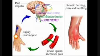 تخصصی ترین کار درمانی در شمال کرج|گفتار توان گستر 09121623463
