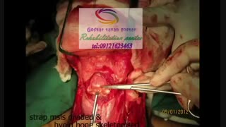 برترین مراکز درمان بیماری های حنجره|گفتار توان گستر البرز09121623463