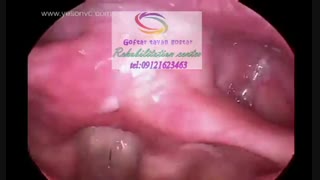 مراکز تخصصی تصویربرداری حنجره شرق کرج|گفتارتوان گستر البرز09121623463