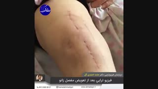(فیزیوتراپی تعویض مفصل زانو در منزل، 09128332821)
