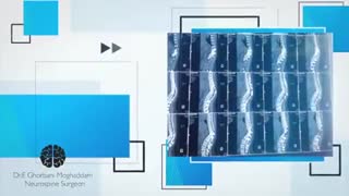 جراحی انحنای ستون فقرات