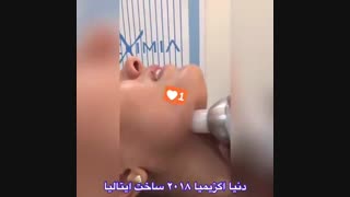 فیلم رفع غبغب و زاویه سازی توسط دکتر سارا لطفی لیپوساکشن