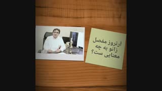 آرتروز مفصل زانو