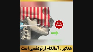 ارتودنسی شمال تهران | متخصص ارتودنسی